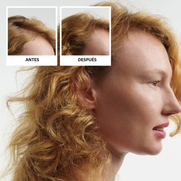 Kit Nioxin Sistema # 1 Cabello Natural Con Debilitamiento Ligero - Imagen 3