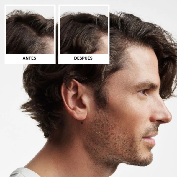 Kit Nioxin Sistema # 2 Cabello Natural Con Debilitamiento Avanzado - Imagen 3